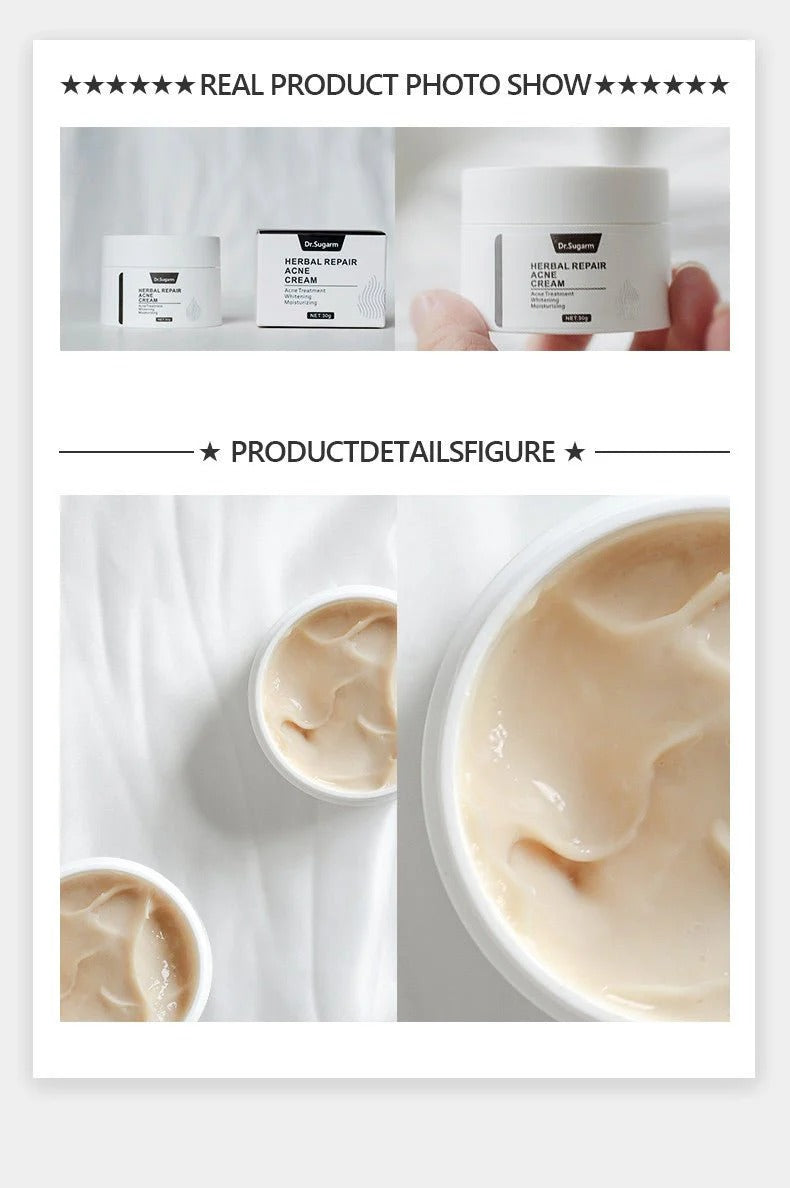 Dr. Sugarm Acne Treatment Cream