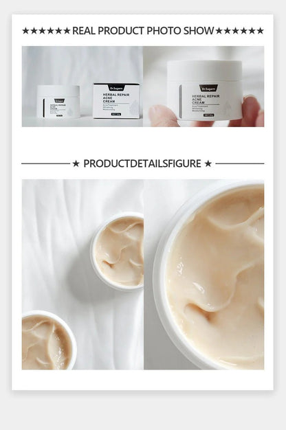 Dr. Sugarm Acne Treatment Cream